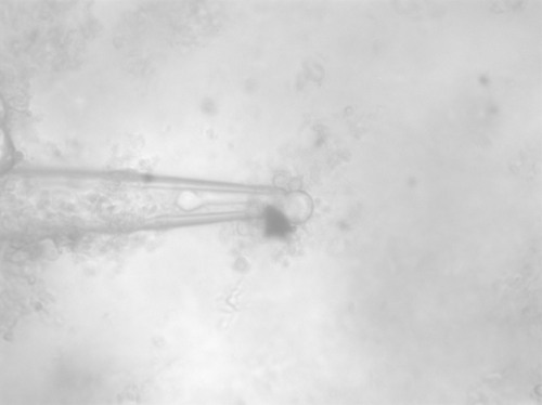 Figure 6: 35.5° C You can see part of the vesicle membrane deforming into the nano-pipette as heating occurs and potential budding at the upper part of the vesicle however because of the issues with suction nothing definitive can be said.